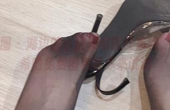 微密圈 – 湖边的小猫咪和圆红布兜，周妍希的免费图包等你来试试